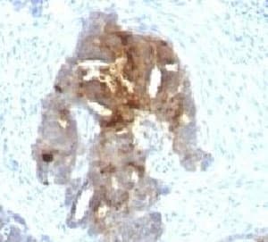 Monoclonal Mouse anti-Human TAG-72 Antibody (clone TAGP-4, IHC, IF)