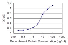 CCL2 / MCP1 Antibody (clone 1F10)