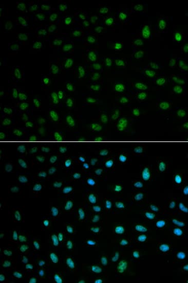 ELAVL1 / HUR Antibody