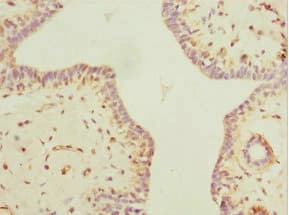 Polyclonal Rabbit anti-Human MYLK3 Antibody (IHC)