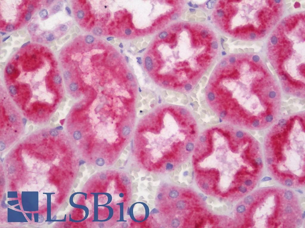 IHC-plus™ Polyclonal Rabbit anti-Human PH / PAH Antibody (aa351-400, IHC, WB)