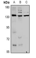 Polyclonal Rabbit anti-Human KCNT1 / KCa4.1 Antibody (IHC, WB)