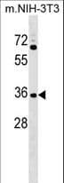 GPATCH11 / CCDC75 Antibody (aa12-41)