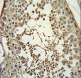 PMCH / MCH Antibody (aa94-122)