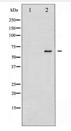 Polyclonal Rabbit anti-Human SYT1 / Synaptotagmin Antibody (IHC, WB)