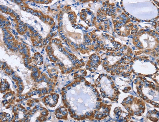 INTS10 Antibody