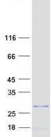Human MRPL47 Protein (Recombinant Myc-DDK (Flag))