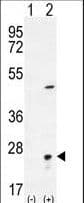 IHC-plus™ Polyclonal Rabbit anti-Human VILIP / VSNL1 Antibody (aa47-75, IHC, WB)