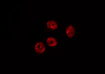 ATF1 Antibody