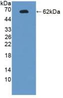 Rat Endonuclease G / ENDOG Protein (Native His-GST, N-terminus)