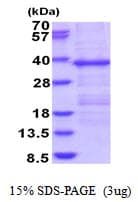 Human HERPUD1 / HERP Protein (Recombinant His)