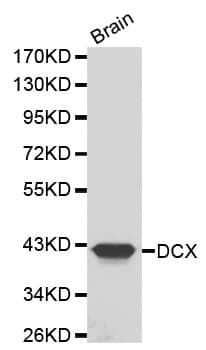 Polyclonal Rabbit anti-Human DCX / Doublecortin Antibody (IHC, WB)