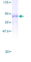 Human PSTPIP1 Protein (Recombinant GST)