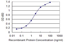 Monoclonal Mouse anti-Human SMS / Spermine Synthase Antibody (clone 1G6, WB)