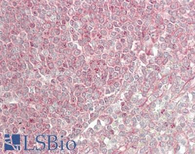 IHC-plus™ BTRCP / BETA-TRCP Antibody