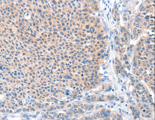 ADAM20 Antibody