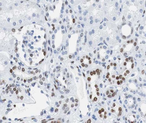 RB1 / Retinoblastoma / RB Antibody (phospho-Ser807)