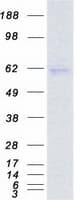Human RORA / ROR Alpha Protein (Recombinant Myc-DDK (Flag))