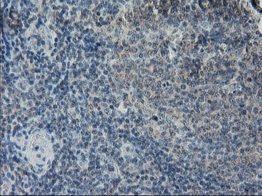 GPR49 / LGR5 Antibody (aa250-550, clone OTI2A2)