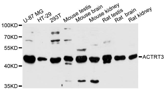 Polyclonal Rabbit anti-Human ARPM1 Antibody (WB)