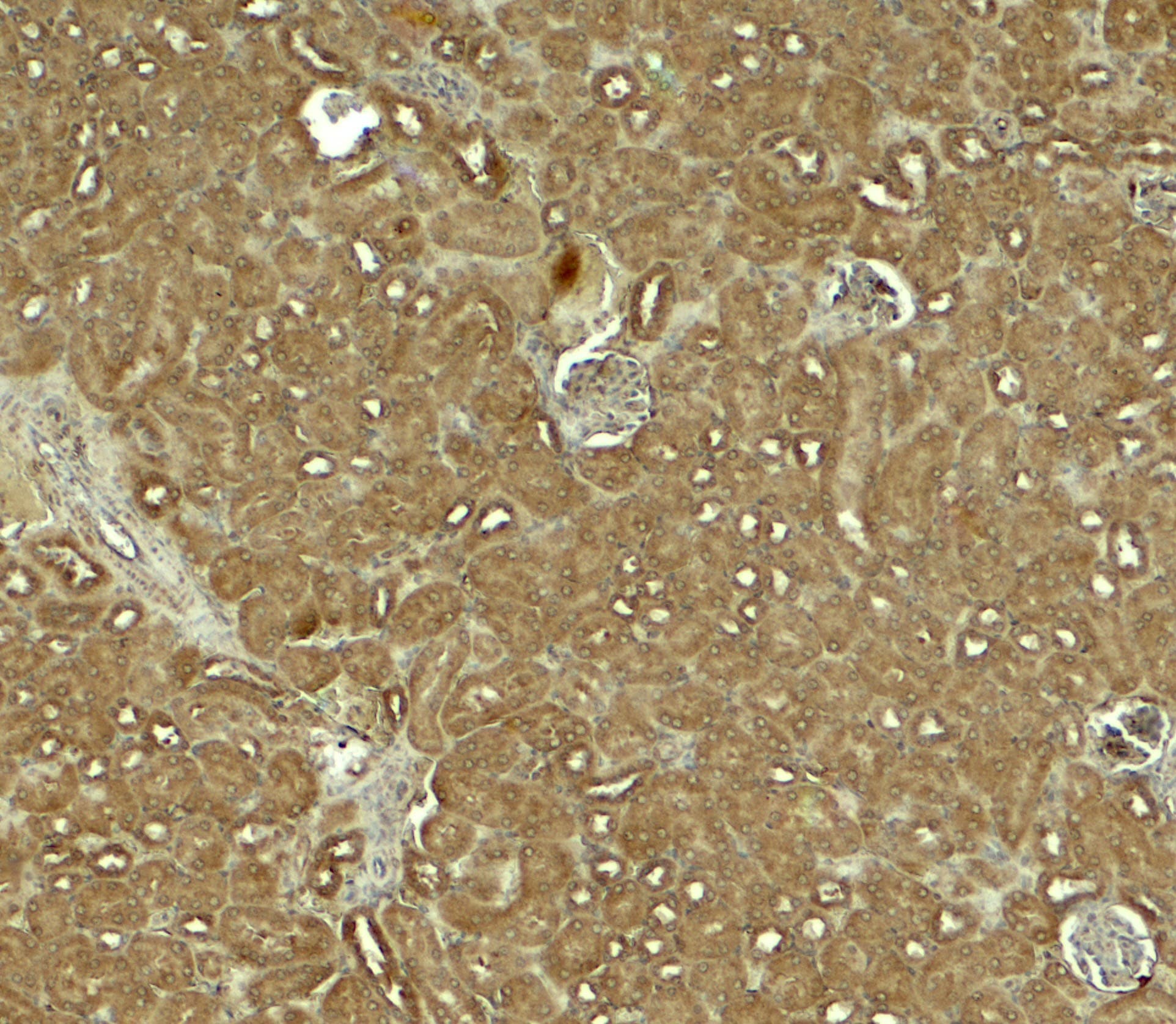 IHC-plus™ Polyclonal Rabbit anti-Human NOSTRIN Antibody (IHC, IF, WB)