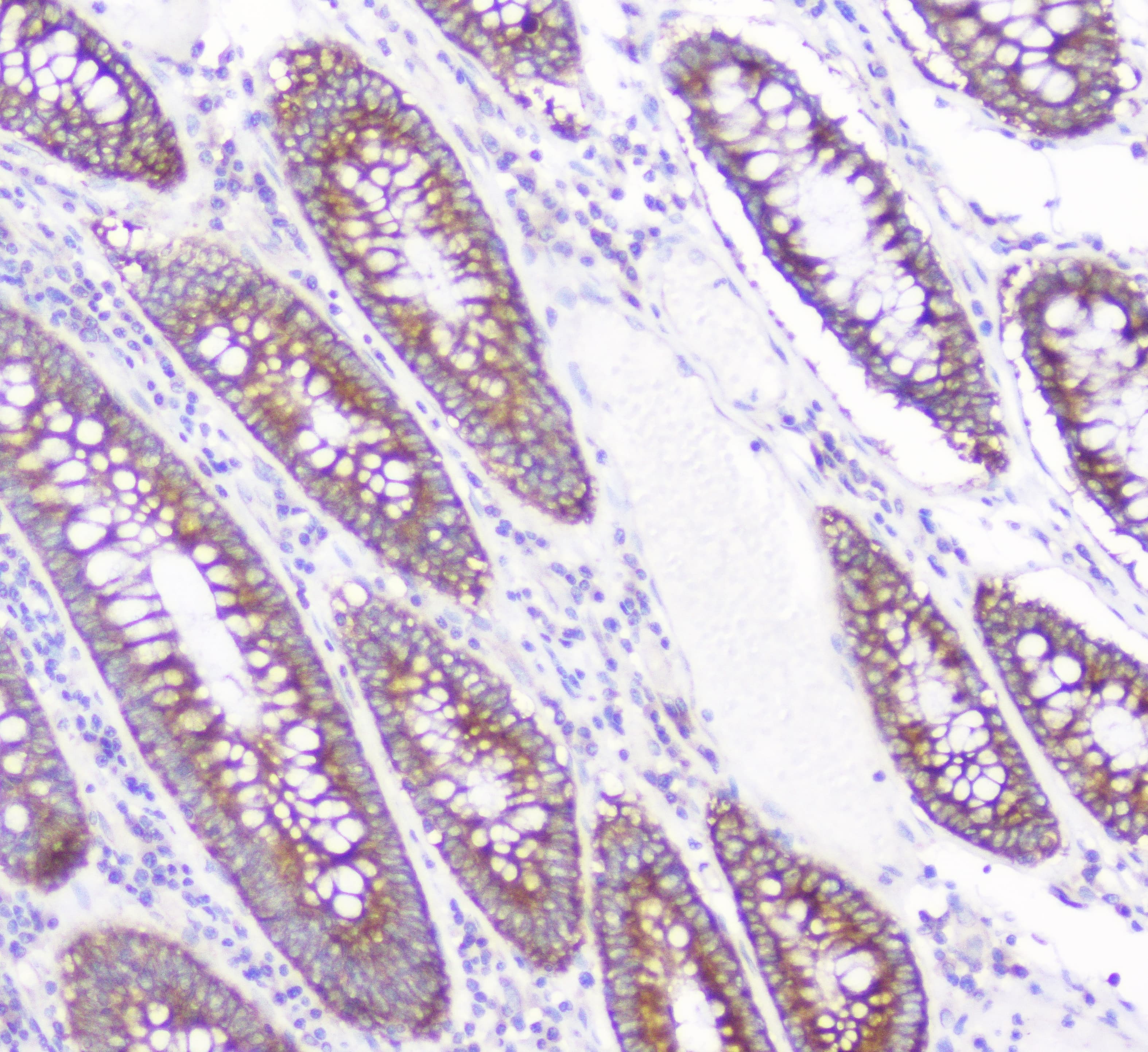 CD2AP Antibody