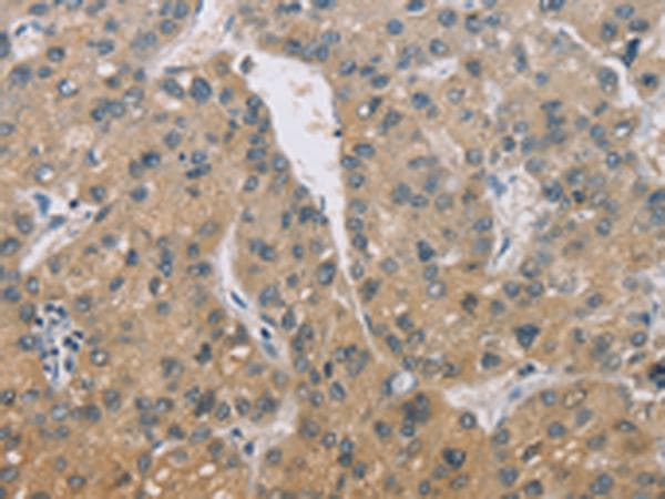 ZBTB6 Antibody