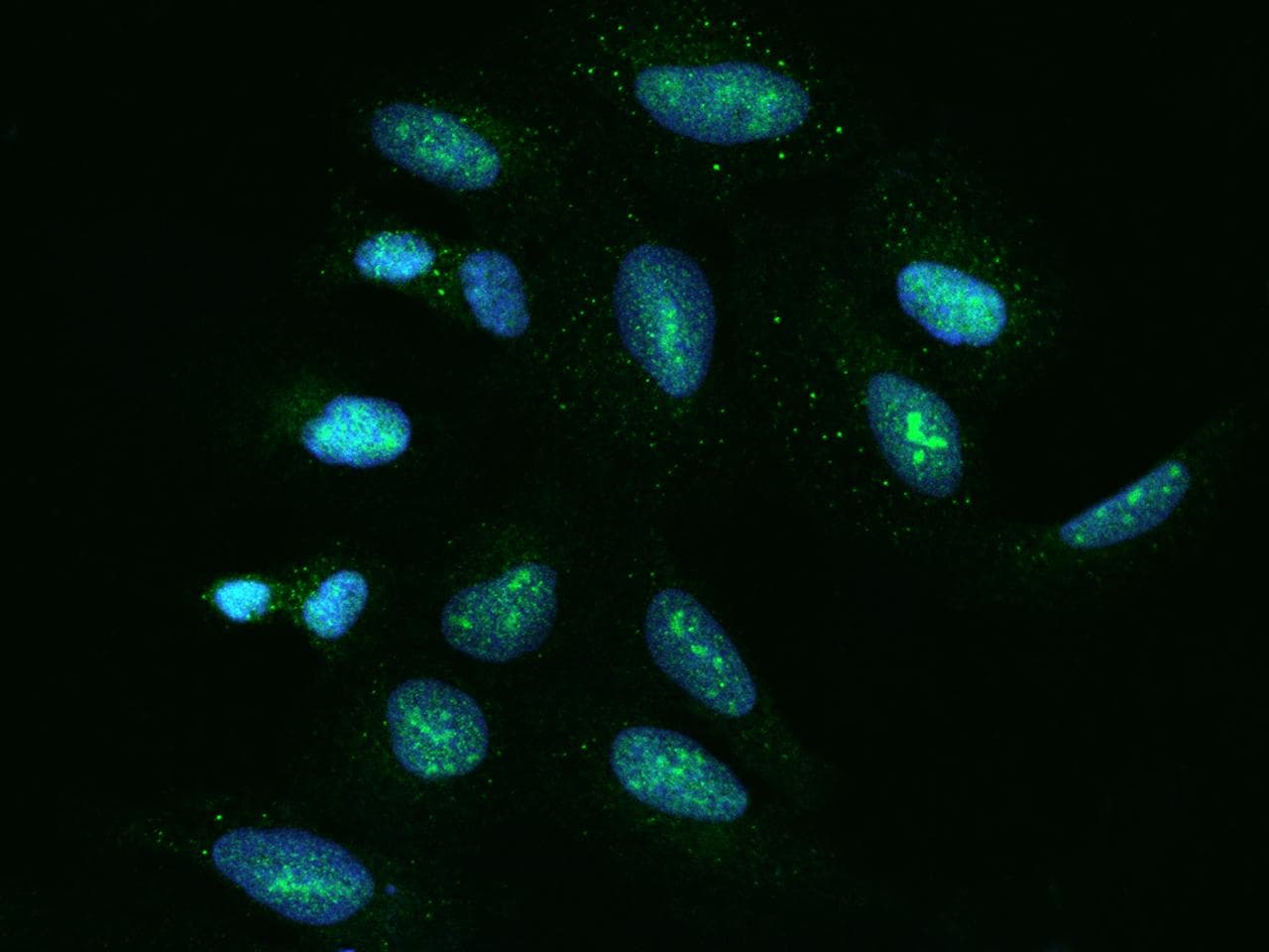 Polyclonal Rabbit anti-Human SDAD1 Antibody (IF)