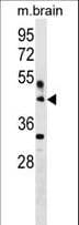 Polyclonal Rabbit anti-Human HAPLN4 Antibody (aa331-357, WB)