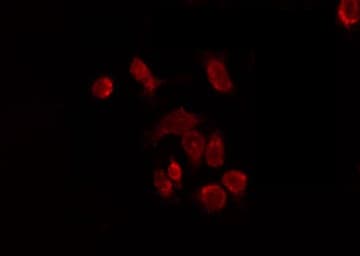 KISS1R / GPR54 Antibody
