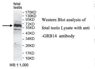 Polyclonal Rabbit anti-Human GRB14 Antibody (aa75-249, IHC, WB)