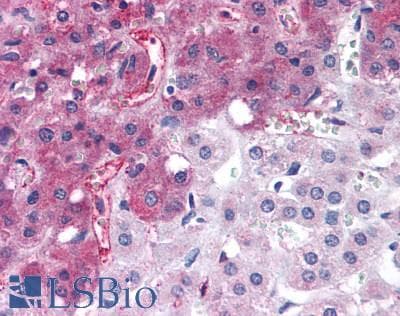 PathPlus™ CRFR1 / CRHR1 Antibody (N-Terminus)
