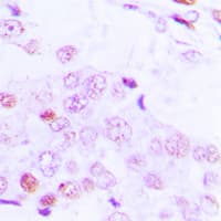ATF2 Antibody (phospho-Thr69)