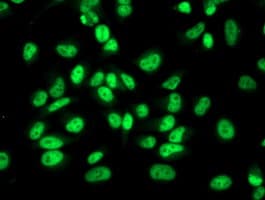 RBP1 / CRBP Antibody (clone OTI2H3)