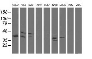 MAP2K3 / MEK3 / MKK3 Antibody (clone OTI1D3, Carrier-free)