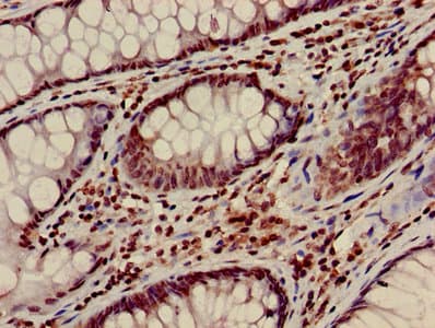 HIST1H3A Antibody