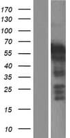 LHX5 Protein (Over-Expression Lysate Myc-DDK (Flag))