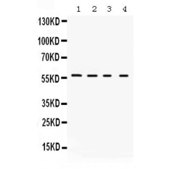Polyclonal Rabbit anti-Human KCNA2 / Kv1.2 Antibody (aa466-499, WB)