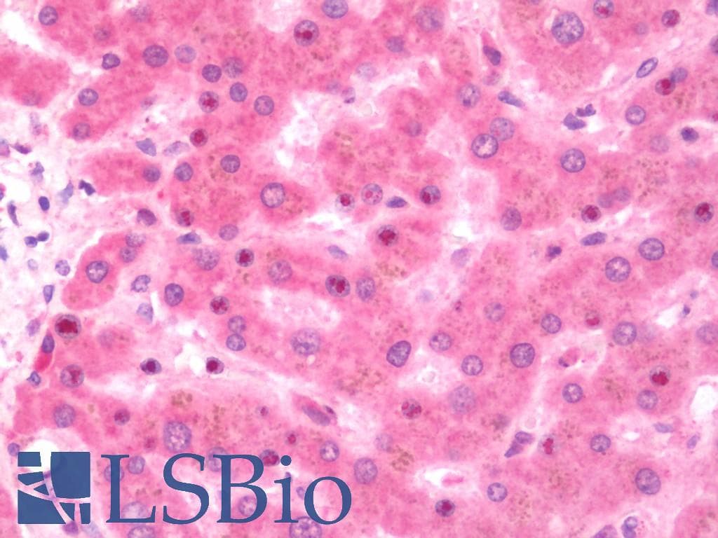 IHC-plus™ ODC1 / Ornithine Decarboxylase Antibody (aa180-461)
