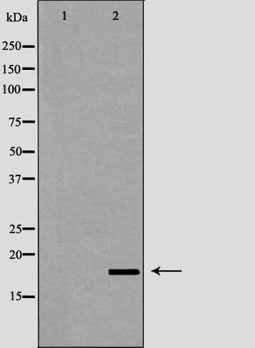 LCN6 Antibody