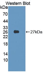 PIM2 / Pim-2 Antibody (aa82-291)