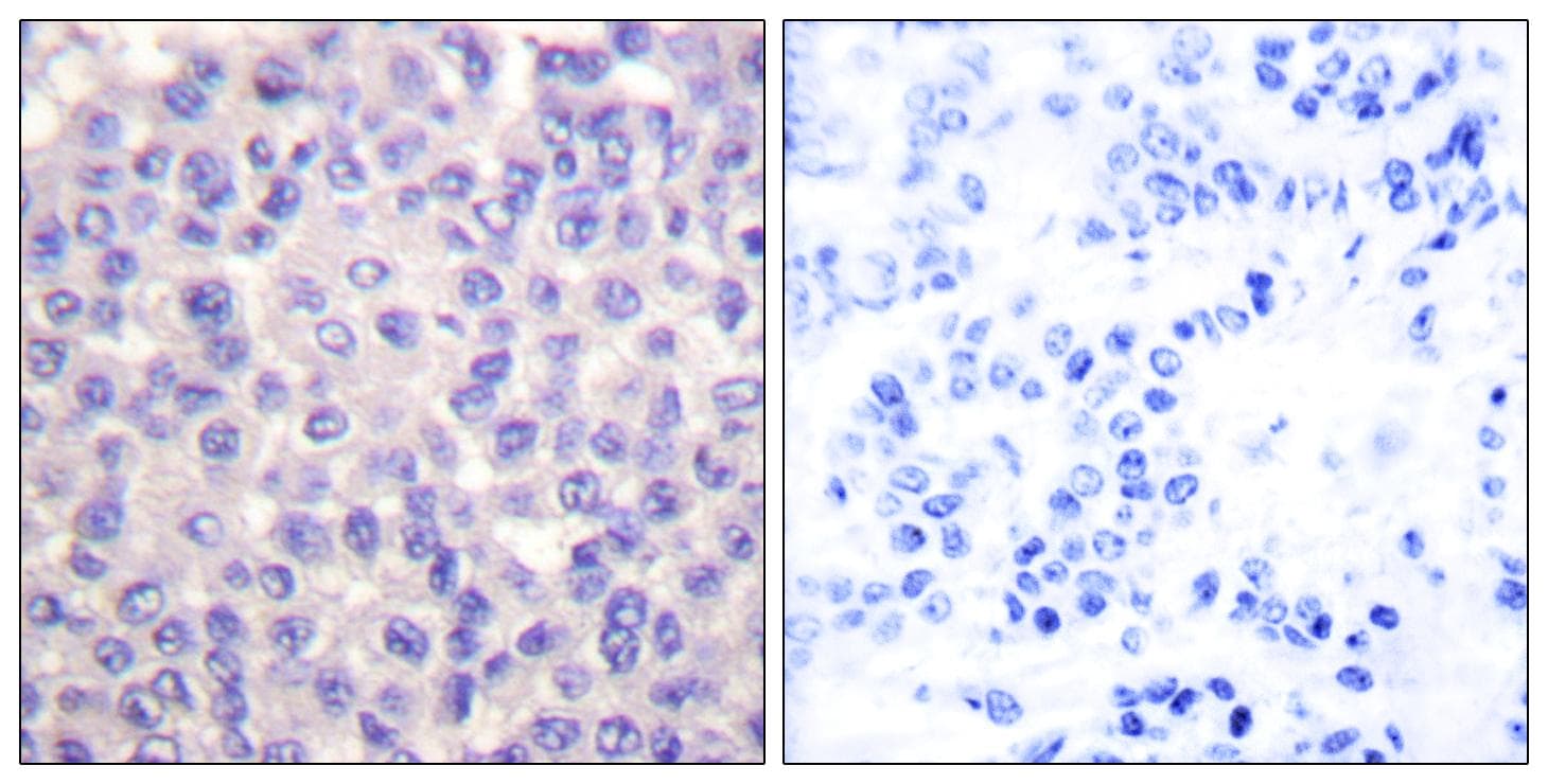 TGFB3 / TGF Beta3 Antibody