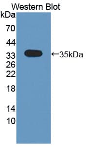 CRLF1 Antibody (aa110-408)
