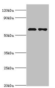 Polyclonal Rabbit anti-Human SOAT1 Antibody (aa1-130, IHC, WB)