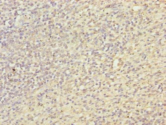 TRXR1 / TXNRD1 Antibody (aa1-497)