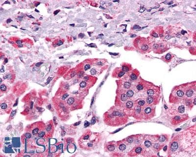 PathPlus™ Polyclonal Rabbit anti-Human ACKR3 / CXCR7 Antibody (Cytoplasmic Domain, IHC, WB)