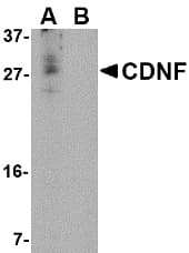 CDNF / ARMETL1 Antibody
