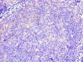 TWF2 / PTK9L Antibody (aa1-369)