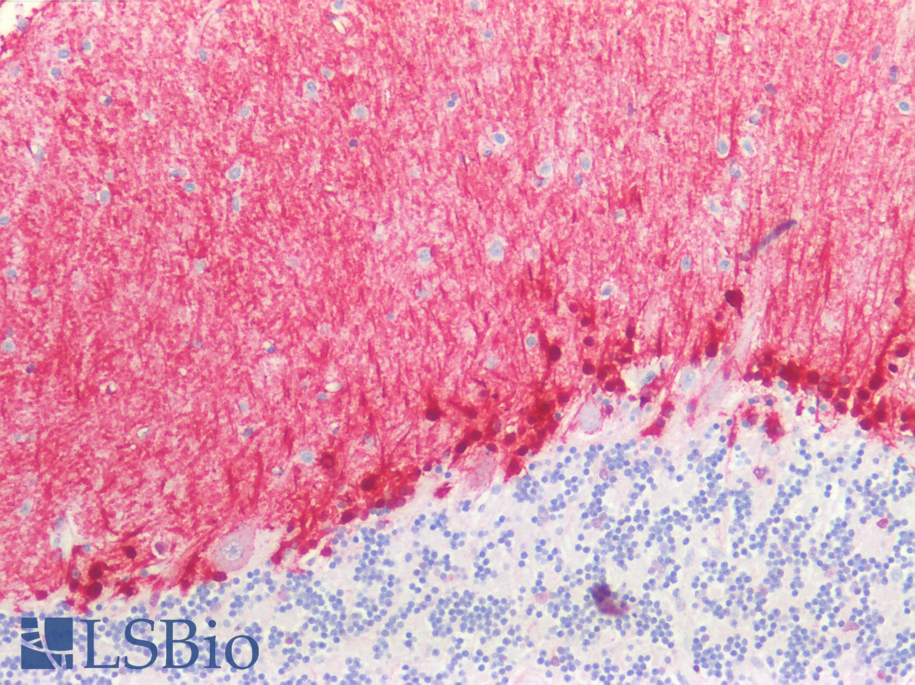 PathPlus™ Polyclonal Rabbit anti-Human BMP6 Antibody (IHC, WB)