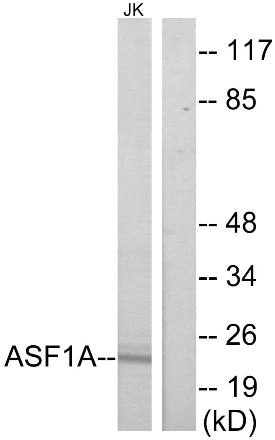 Polyclonal Rabbit anti-Human ASF1A Antibody (aa121-170, WB)